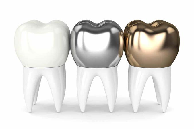 Dental Crown Materials